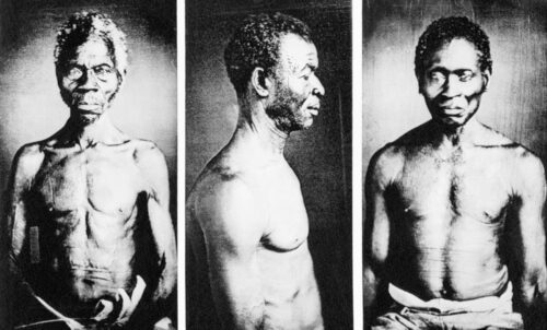 3546 Photographs of enslaved people in the US, possibly the oldest known in the country, were discovered in the basement of a Harvard University museum in 1977. (Bettmann Archive)
